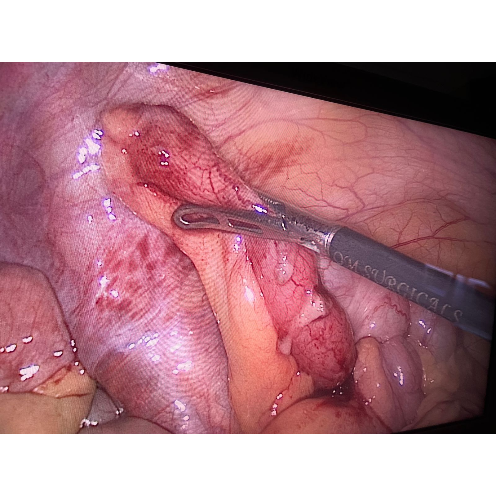 Appendix