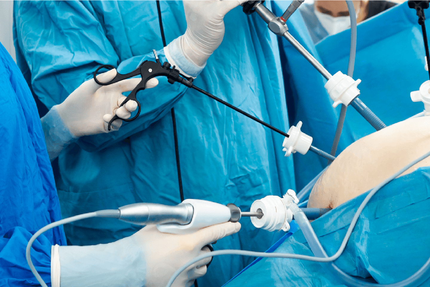 Laparotomy / Trauma Surgery