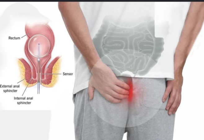 Anorectal Surgery